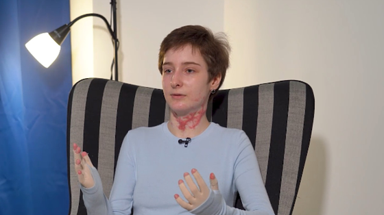 Все тіло пече… Адський біль! Ми з бабусею — єдині, хто вижили Все тіло пече… Адський біль! Ми з бабусею — єдині, хто вижили